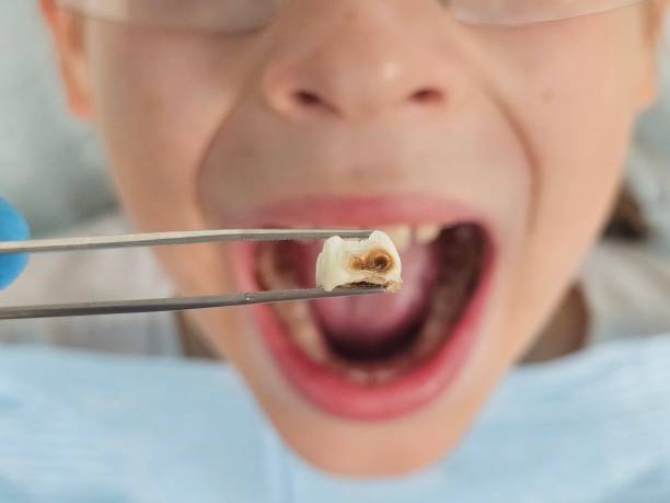 Best Emergency Tooth Extraction  in North Utica, IL
